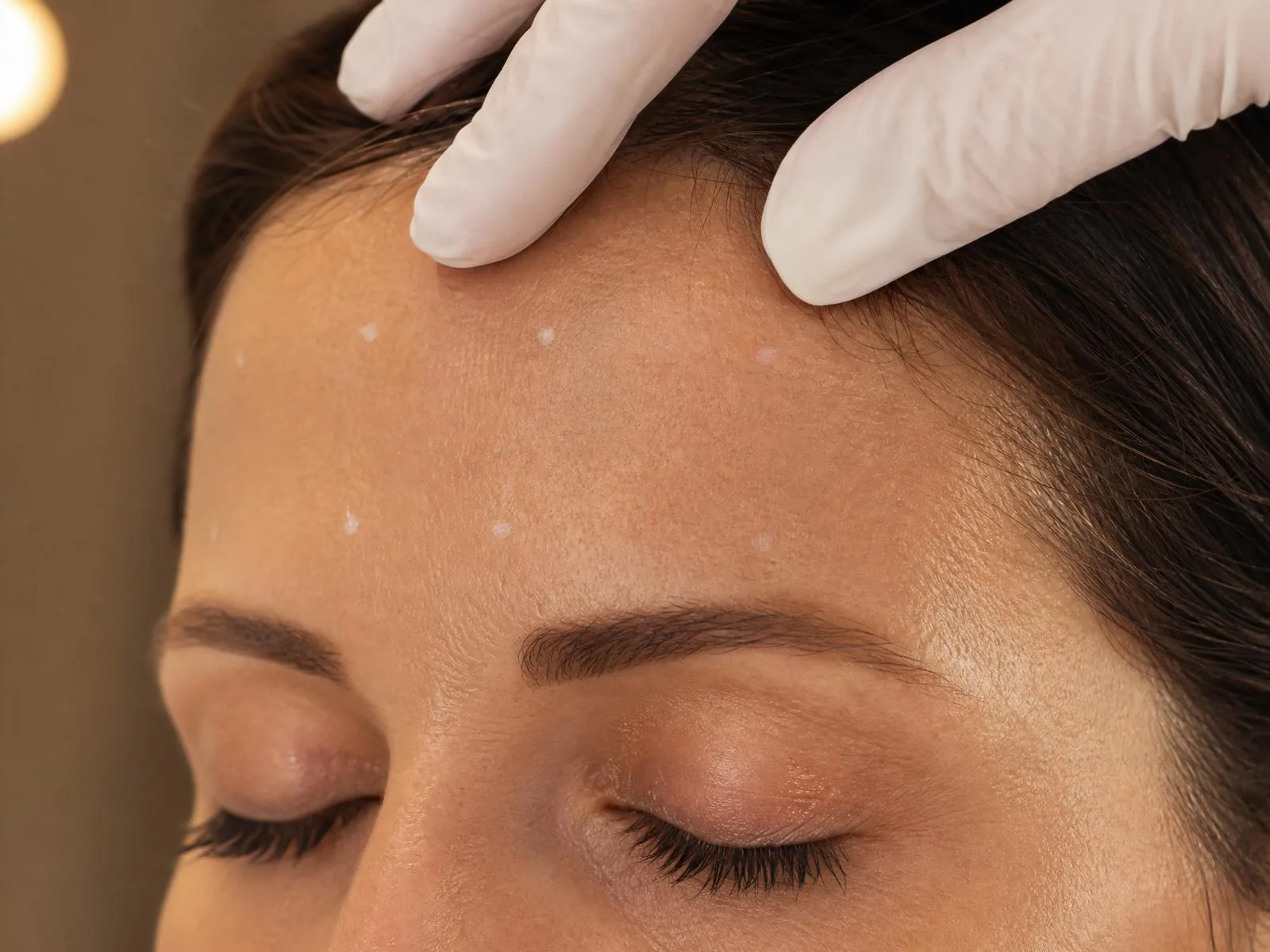 Toxina Botulínica (Botox)