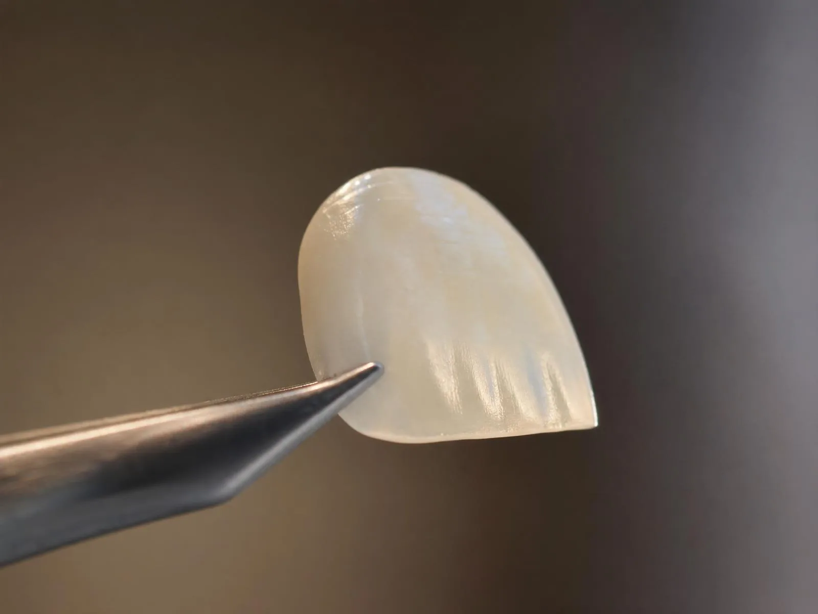 Lentes de Contato Dental